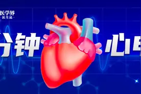 没有任何症状，心电图却有异常？| 1分钟心电挑战图片