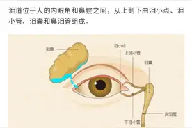 迎风流泪警惕3类疾病图片
