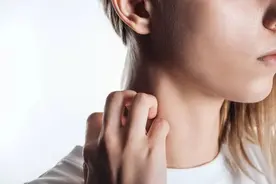 脖子上长疙瘩，是癌症？脖子有一圈黑黑的，是病吗？一文说清楚！图片