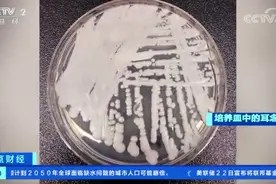 “超级真菌”要来了？遍布美国一半以上州，传播速度惊人！图片