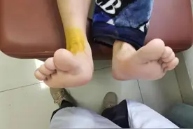 脚踝扭伤后，养养就能好是真的吗？是该热敷还是冰敷？选对方式很重要图片