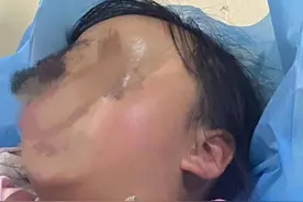 惊险! 铅笔刺入女孩颈部8厘米图片