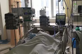 太危险！青岛36岁男子因头疼自行在家针灸，结果…心脏破了！图片