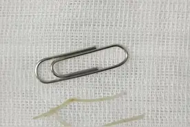 杭州男子被查出肠穿孔，肛肠医生特别强调：这些行为很危险图片