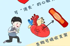 山东大学齐鲁医院德州医院成功开展冠状动脉生物可吸收支架置入术图片