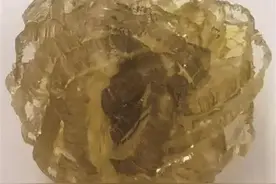 太稀奇，浙江女子身体里取出“花”！老公：打算做成钻戒或饰品图片