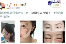 “我的脸被它毁容了！”这种虫子，千万别拍！图片