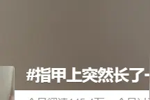 指甲上突然长了一条黑线，网友慌了……图片