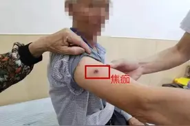 一地近10人确诊！早期症状像感冒，严重可致命！图片