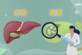 一文看懂！体检查出肝囊肿、胆囊结石、息肉等问题，到底该如何应对？图片