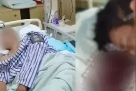 一男子紧急送入ICU，“吐血成植物人”！高温持续，要当心这种病→图片