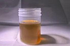 每天一杯新鲜胆汁！面对癌王，医生的操作绝了！图片