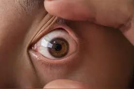 打个喷嚏，眼睛就看不见了！请警惕这种眼病图片