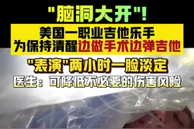 “脑洞大开”！美国小伙边做开颅手术边弹吉他图片