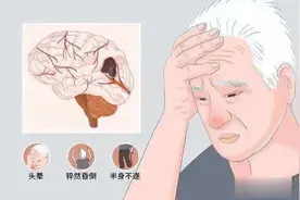 脑供血不足的人，一般有这4个症状！如何改善？快来看→图片