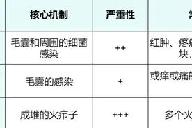 这种“红包”又痛又肿，硬挤还很危险图片