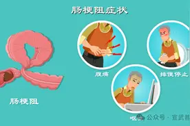 肠梗阻要做手术吗？图片
