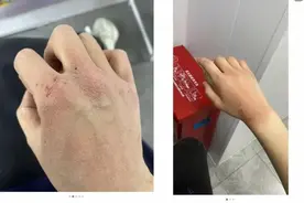 “烂手”冲上热搜第一！知名咖啡店员工都在晒图片