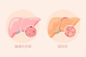 拒绝盲目减肥！中老年人群科学减重记住四个要点→图片