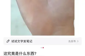 广东已大量出现！最近又到高峰期！紧急提醒→图片