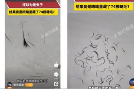 女子一次掉落74根眼睫毛！提醒：可能与螨虫感染、种植假睫毛等有关|网红说法求真图片