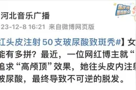 追求“高颅顶”注射50来支玻尿酸，百万粉丝女网红变成“鬼剃头”图片