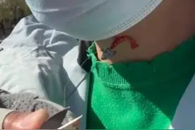 闪电律解｜女子河边散步遭鱼钩“封喉” 钓鱼大爷：去告我吧 律师：赔偿争议可提起诉讼图片