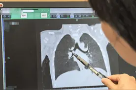 既没发烧也没感染，孩子为啥久咳不愈？竟是因为很多人都爱吃的它图片