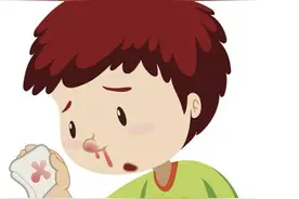 孩子鼻出血不要慌，做好这几点很重要图片