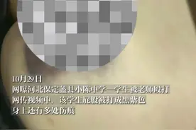 官方回应学生屁股被老师打成黑紫色：正调查，孩子已无大碍官方回应学生屁股被老师打成黑紫色：正调查，孩子已无大碍图片