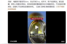 初中生因好奇将14颗磁力珠塞尿道图片