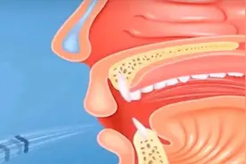 全国爱鼻日丨关爱鼻腔健康，小心病从鼻入图片