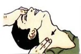 你知道什么是”颈动脉体瘤”吗？图片