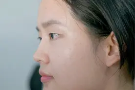 极重度听障女孩，到28岁重学说话图片