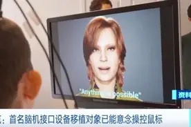 通过大脑意念控制！马斯克宣布图片