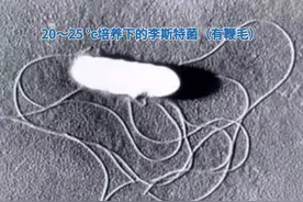 喝了口冰箱里的剩牛奶，女子感染败血症！这种菌严重会致死图片