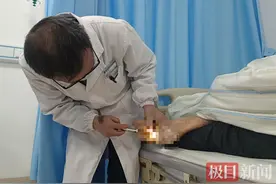 男子热水泡脚发生严重感染，医生提醒这类人要特别注意！图片