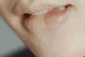 嘴唇干裂脱皮，涂唇膏也不管用？未必是缺水，可能是这种炎症→图片