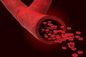 尿酸高很伤动脉图片