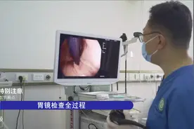 无痛胃镜 看“清”你的胃图片