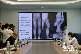 西安市红会医院完成世界首例机器人辅助下行全踝关节置换术图片