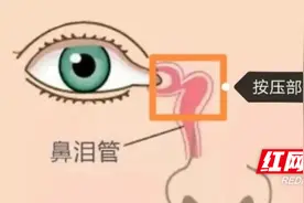 永医科普丨小宝宝眼泪汪汪，是上火了吗？图片