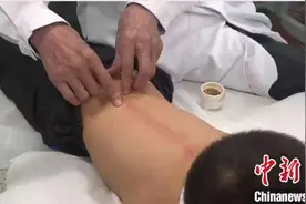 应对小儿常见问题中医外治有好办法图片