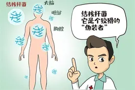 当“狡猾隐匿者”遇上医学侦探，听临床专家揭秘结核病的“伪装术”图片