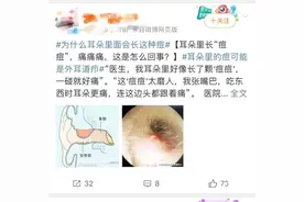 男大学生耳朵里长颗“痘”，头都跟着痛！医生：这不是痘！图片