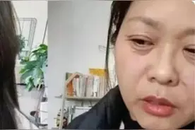 42岁女子经历20天“断崖式衰老”！8个生活习惯是衰老“加速器”图片