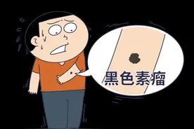 别再乱点痣了！痣出现这5种情况小心恶变，赶紧自查→图片