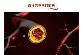 世界血栓日图片