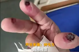年末大扫除，这些清洁剂混着用可能会“伤人”！千万要注意→图片