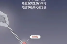 漫画科普：曾属于人体的一部分，手术切除后将归往何处？图片